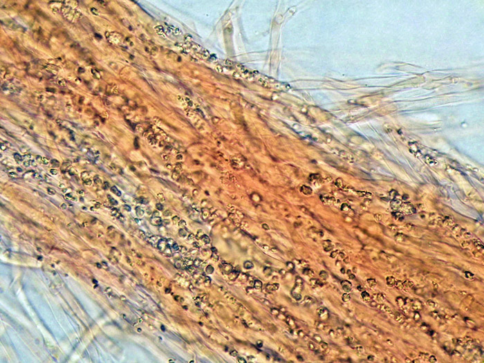 Crosta bianca da determinare  (Trechispora fastidiosa)